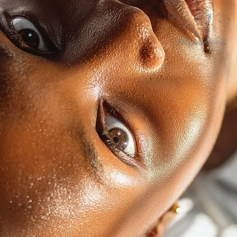 Microagulhamento Facial em Ribeirão Preto — Regiane Sieto